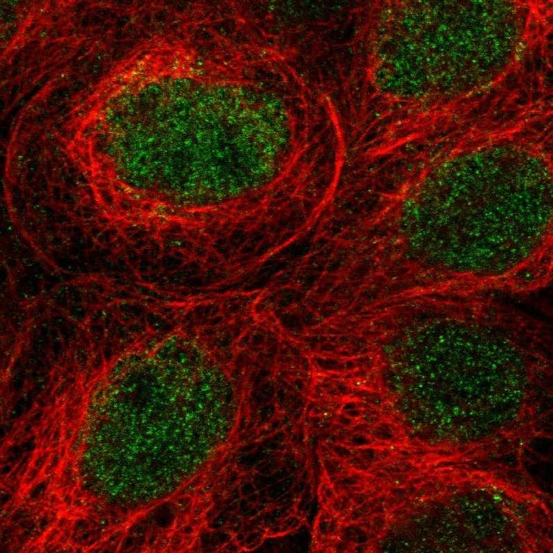 Staining of human cell line A-431 shows localization to nucleus.