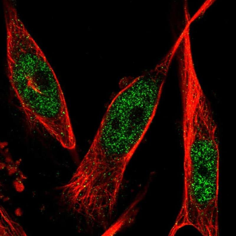 <b>Orthogonal Strategies Validation. </b>Staining of human cell line U-251 MG shows localization to nucleoplasm.
