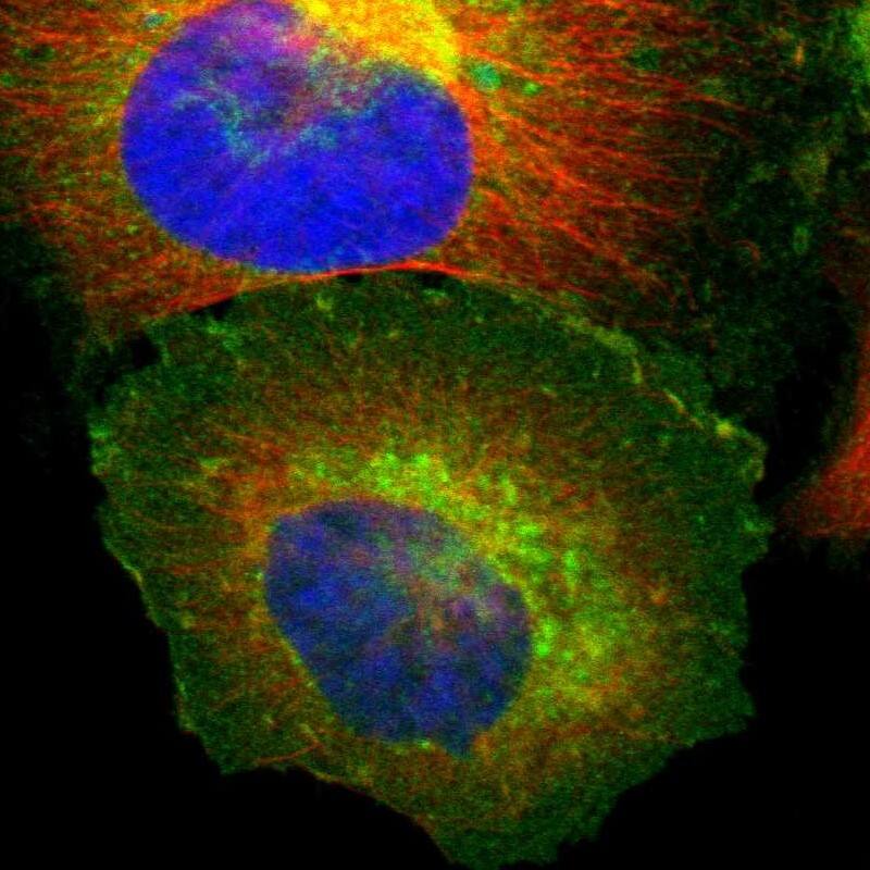 Staining of human cell line U-251 MG shows localization to plasma membrane, cytosol & the Golgi apparatus.