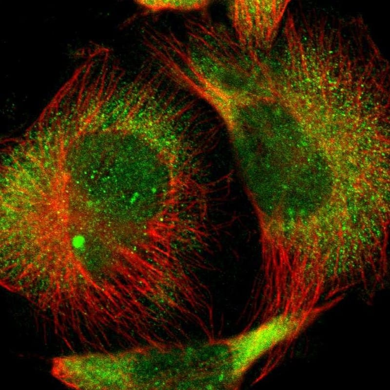 Staining of human cell line U-251 MG shows localization to nucleoplasm & cytosol.