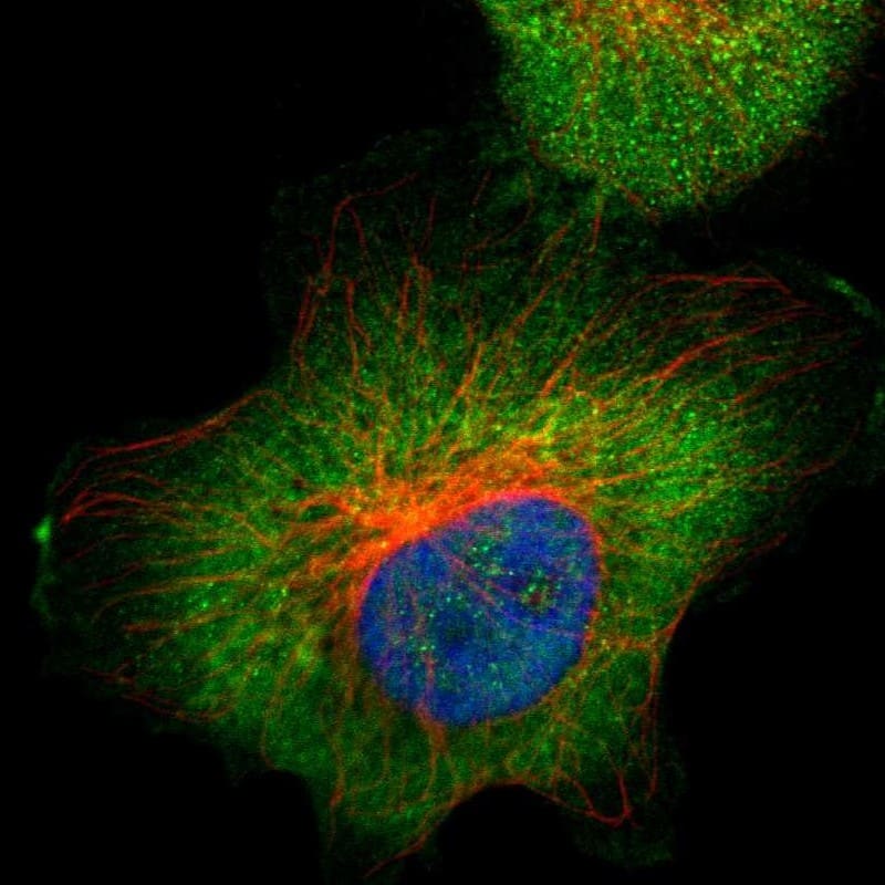 Immunocytochemistry/ Immunofluorescence Aldolase A Antibody - BSA Free