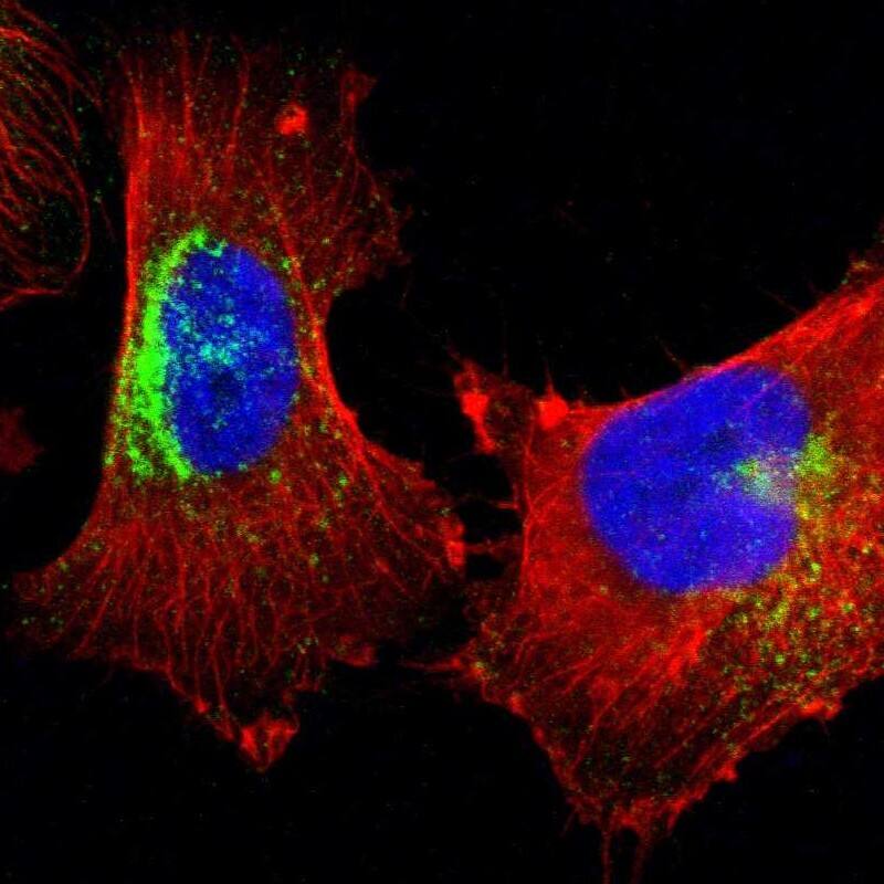 Staining of human cell line U-251 MG shows localization to lysosomes.