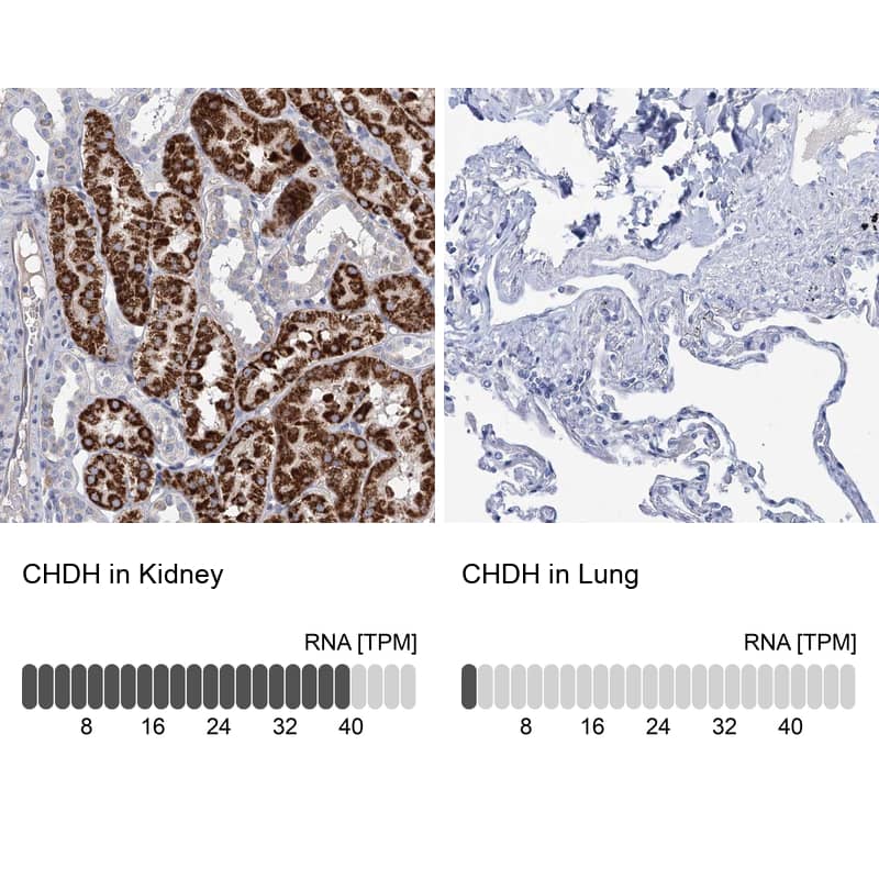 Immunohistochemistry-Paraffin Choline dehydrogenase Antibody - BSA Free