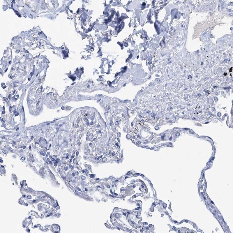 Immunohistochemistry-Paraffin Choline dehydrogenase Antibody - BSA Free