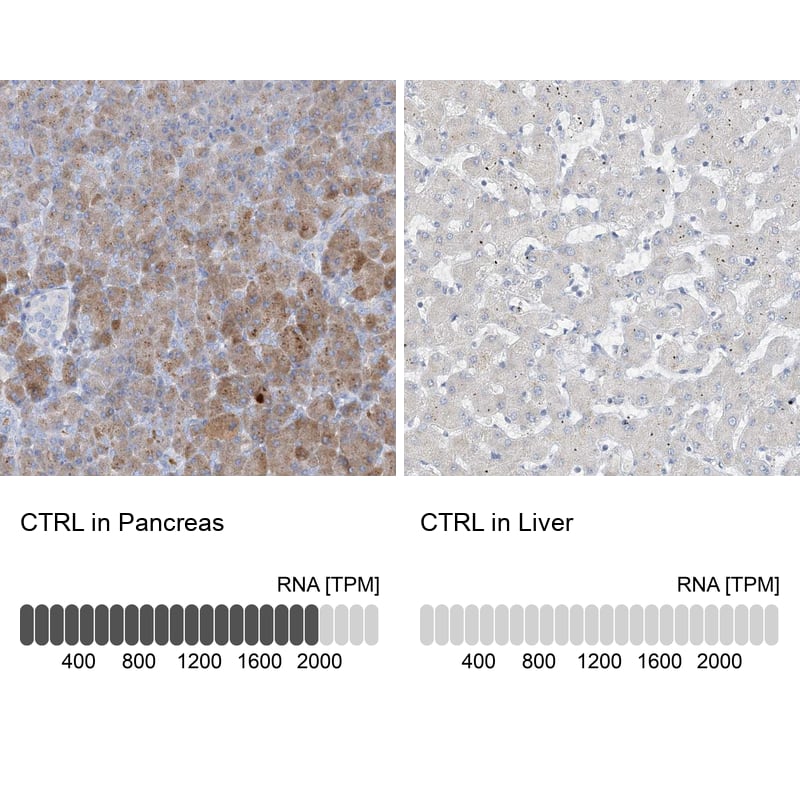 <b>Orthogonal Strategies Validation. </b>Analysis in human pancreas and liver tissues.