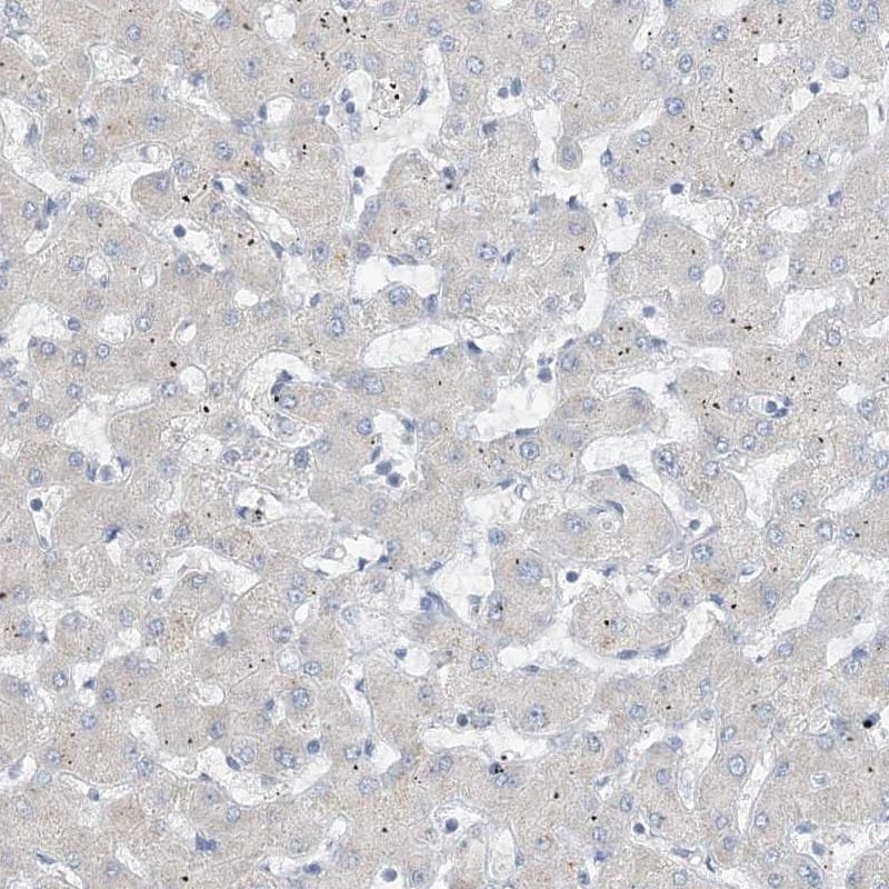 Staining of human liver shows low expression as expected.