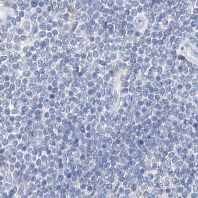Staining of human lymph node.