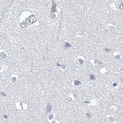 Staining of human cerebral cortex.