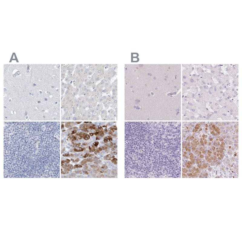 <b>Orthogonal Strategies Validation. </b>Staining of human cerebral cortex, liver, lymph node and pancreas HPA034505 (A) shows similar protein distribution across tissues to independent antibody HPA034504 (B).