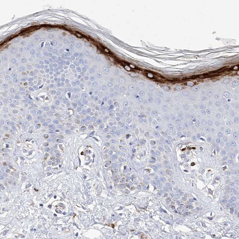 Immunohistochemistry-Paraffin Filaggrin Antibody - BSA Free