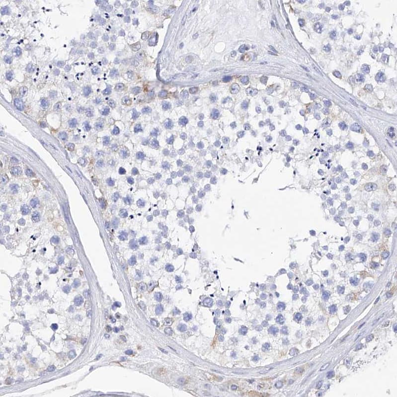Staining of human testis shows negative to very weak positivity in a subset of cells in seminiferous ducts.