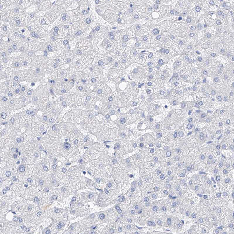 Staining of human liver shows no positivity in hepatocytes as expected.