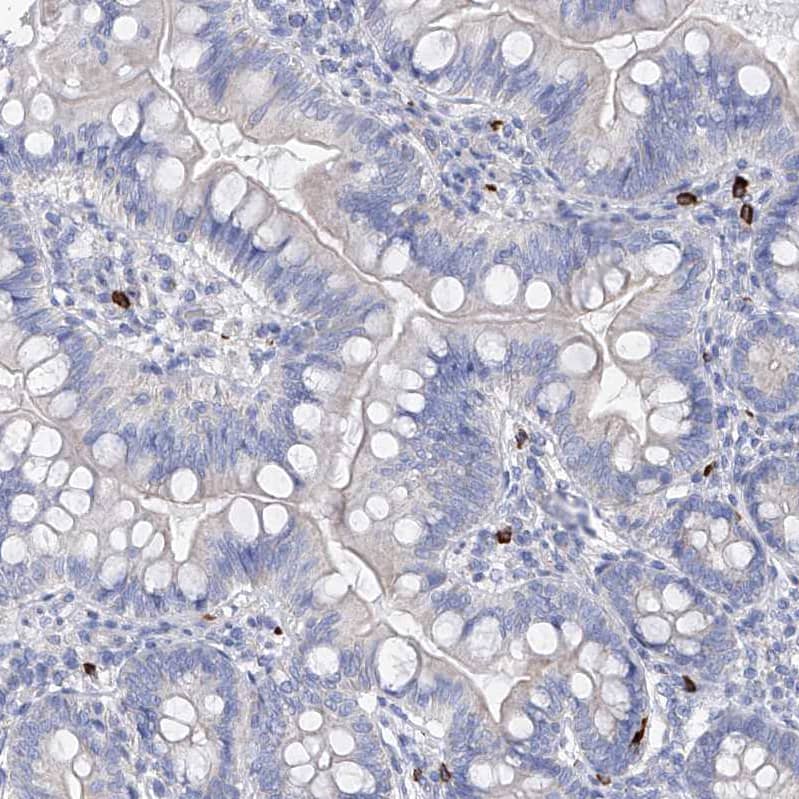 Staining of human gastrointestinal shows no positivity in glandular cells as expected.