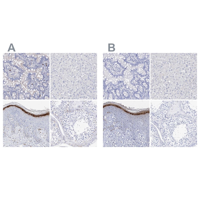 Staining of human gastrointestinal, liver, skin and testis HPA030188 (A) shows similar protein distribution across tissues to independent antibody HPA030189 (B).