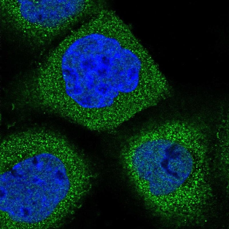 Staining of human cell line A-431 shows localization to cytosol.