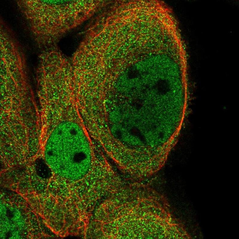 Staining of human cell line A-431 shows localization to nucleoplasm & cytosol.