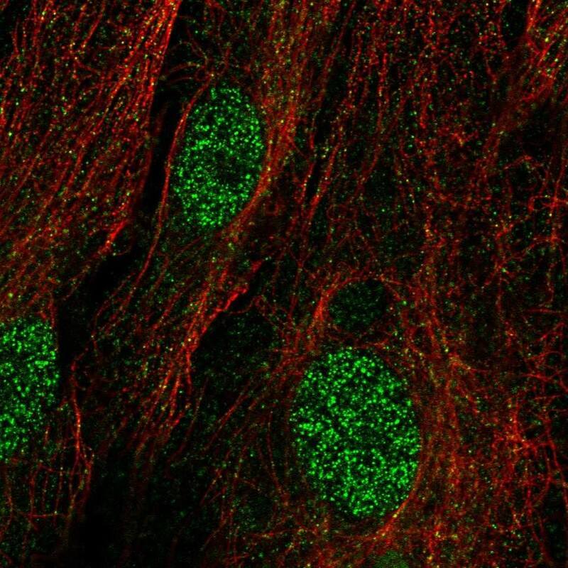 Staining of human cell line BJ shows localization to nucleoplasm & cytosol.