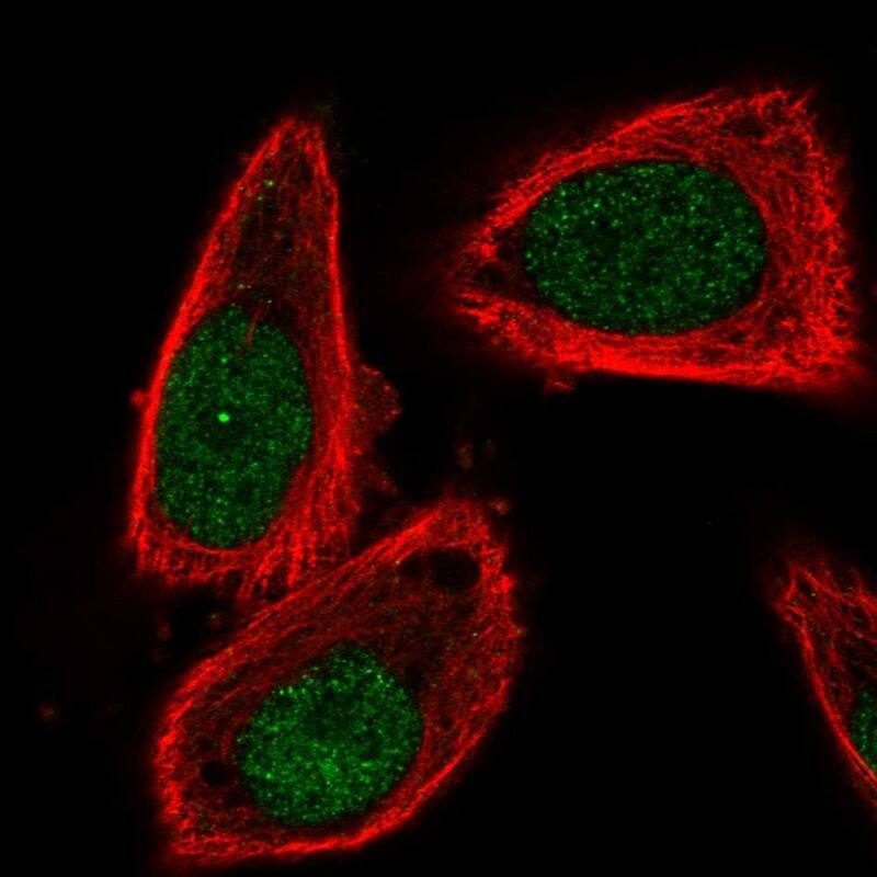 Staining of human cell line PC-3 shows localization to nucleoplasm.