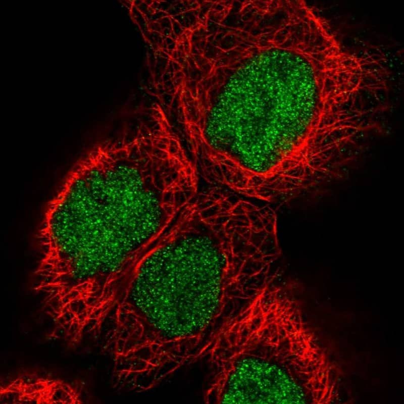 Staining of human cell line A-431 shows localization to nucleoplasm.
