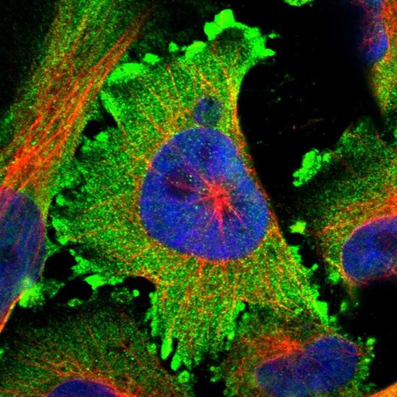 Staining of human cell line U-251 MG shows localization to plasma membrane & cytosol.