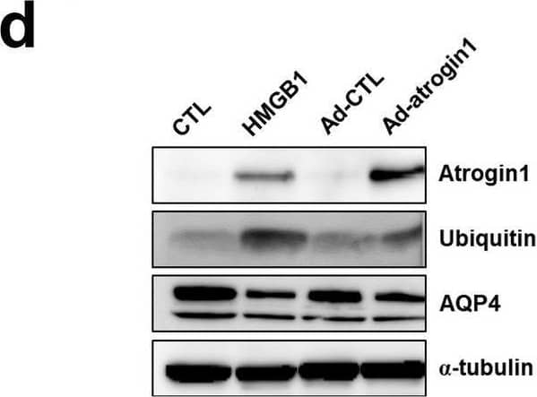 Increased levels of HMGB1 protein in muscle injured by rotator cuff tear (RCT). (a) Expression level of HMGB1 protein in muscle isolated at different stages after RCT (n = 7 per group). Densitometric analyses of the western blots are shown on the right. Data represent means +/- standard errors of the means. *P < 0.05. (b) Immunofluorescence (IF) microscopy analyses of muscle cells isolated at different stages after RCT. The green signal represents HMGB1 protein. The negative control (secondary antibody only) for the IF showed no specific signal (data not shown). (c) Expression of atrogin 1 mRNA in C2C12 myotubes treated with 200 ng/mL recombinant mouse HMGB1 for the indicated time periods. (d) Atrogin 1, ubiquitin, and AQP4 protein levels in C2C12 myotubes treated with 200 ng/mL HMGB1 and an adenovirus expressing atrogin 1 [Ad-atrogin 1; multiplicity of infection (MOI) = 100] for 48 h. (e) Ubiquitination of AQP4 caused by HMGB1 and atrogin 1. C2C12 myotubes were treated with 200 ng/mL HMGB1 and Ad-atrogin 1 (MOI = 100) with or without MG132. After 48 h of incubation, cell lysates were prepared for a ubiquitination assay using anti-AQP4 and anti-ubiquitin antibodies. (f) Expression of atrogin 1 mRNA in C2C12 myotubes exposed to 5 μM SB203580 (a p38 MAPK inhibitor), LY294002 (a PI3K inhibitor), BAY 11-7082 (an NF-kappa B inhibitor), PD98059 (an MEK inhibitor), or SP600125 (a JNK inhibitor). Cells were exposed to each inhibitor for 1 h prior to treatment with 200 ng/mL HMGB1 for 24 h. Image collected and cropped by CiteAb from the following open publication (//pubmed.ncbi.nlm.nih.gov/32843684), licensed under a CC-BY license. Not internally tested by Novus Biologicals.