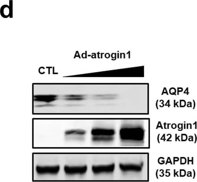 Induction of atrogin 1 mRNA and protein expression by rotator cuff tear (RCT). (a) Expression of transcripts encoding the E3 ubiquitin-protein ligases atrogin 1, MuRF1, and UBR2 in injured muscle after RCT (n = 12 per group). (b) Atrogin 1 protein expression in muscle isolated at different stages after RCT (n = 7 per group). Densitometric analyses of the western blots are shown on the right. Data represent means +/- standard errors of the means. *P < 0.05. (c) Immunofluorescence (IF) microscopy analyses of muscle isolated at different stages after RCT. The red signal represents atrogin 1 protein. The negative control (secondary antibody only) for the IF showed no specific signal (data not shown). (d) Loss of AQP4 protein by overexpression of atrogin 1. C2C12 cells were treated with an adenovirus expressing atrogin 1 [Ad-atrogin 1; multiplicity of infection (MOI) = 50, 100, 200] for 48 h, and western blot analysis was performed with each designated antibody. (e) Monomeric ubiquitin protein expression in muscle cells isolated at different stages after RCT. Image collected and cropped by CiteAb from the following open publication (//pubmed.ncbi.nlm.nih.gov/32843684), licensed under a CC-BY license. Not internally tested by Novus Biologicals.