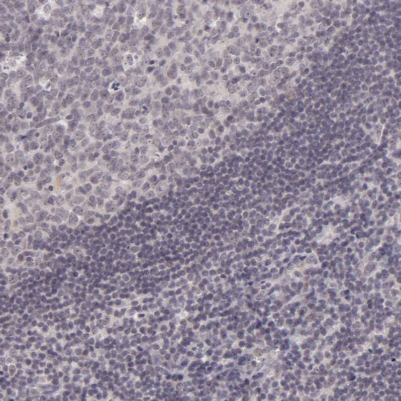 Immunohistochemistry-Paraffin SAP102 Antibody - BSA Free