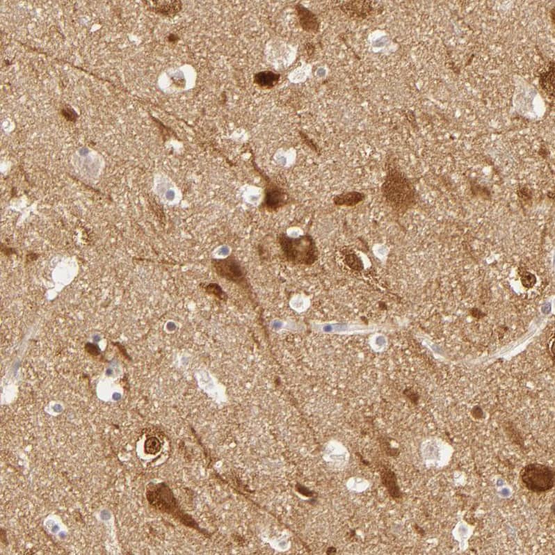 Immunohistochemistry-Paraffin SAP102 Antibody - BSA Free