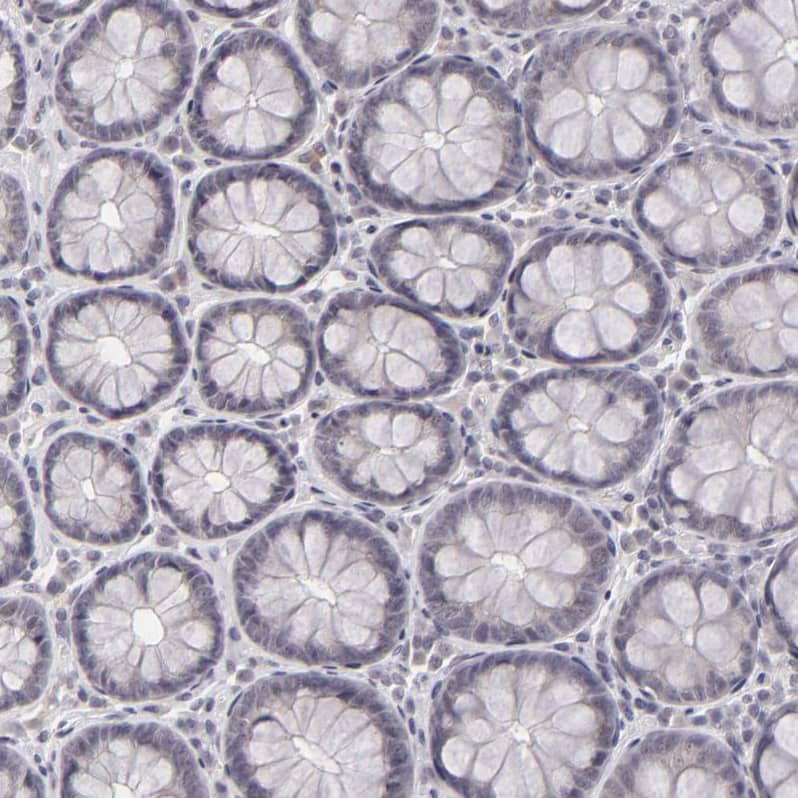 Immunohistochemistry-Paraffin SAP102 Antibody - BSA Free