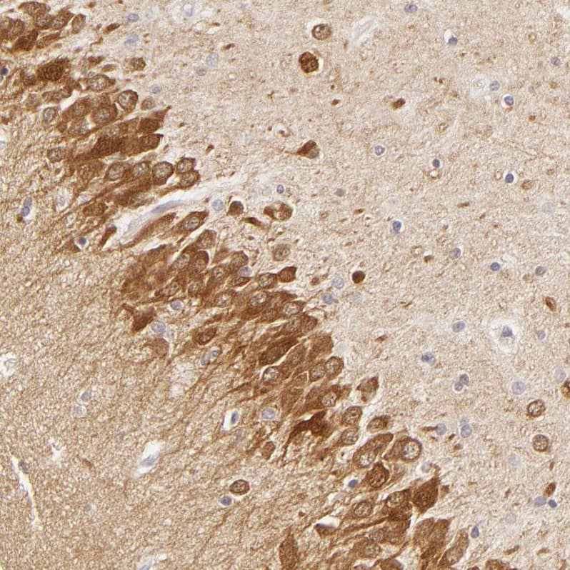 Immunohistochemistry-Paraffin SAP102 Antibody - BSA Free