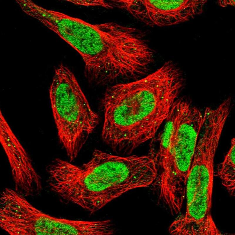 Staining of human cell line U-2 OS shows localization to nucleoplasm & vesicles.