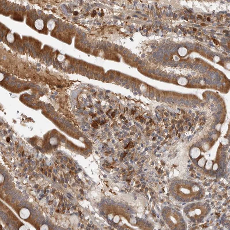 Staining of human small intestine shows moderate to strong cytoplasmic positivity in lymphoid cells.