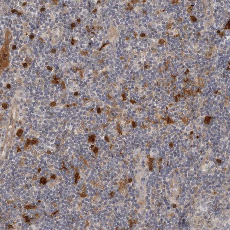 Staining of human tonsil shows moderate to strong cytoplasmic positivity in lymphoid cells.