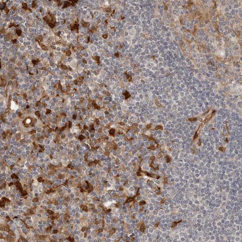 Staining of human lymph node shows strong cytoplasmic positivity in lymphoid cells.