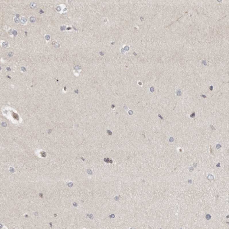 Staining of human cerebral cortex shows no positivity in neurons as expected.