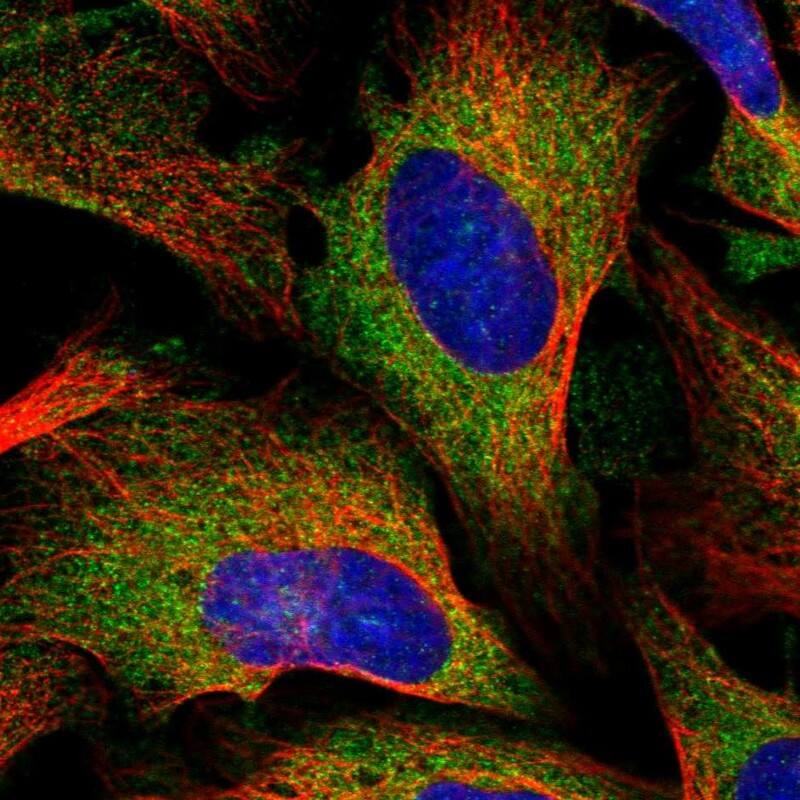 Staining of human cell line U-2 OS shows localization to cytosol.