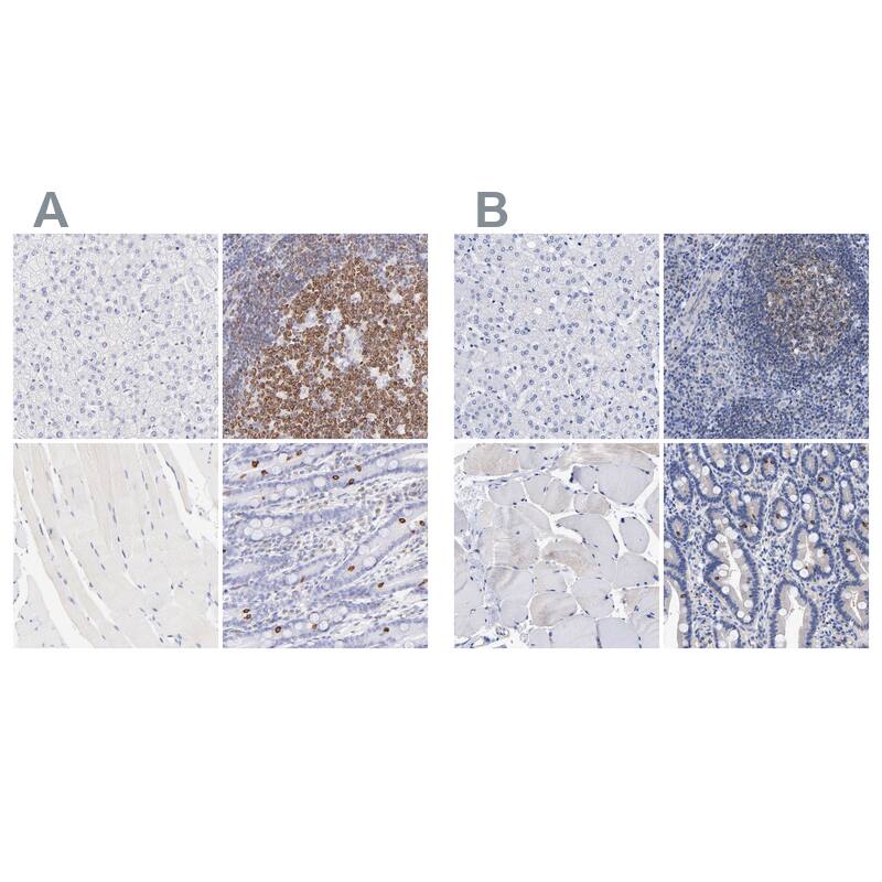 <b>Independent Antibodies Validation. </b>Staining of human liver, lymphoid tissues, skeletal muscle and upper gastrointestinal using NBP1-87724 (A) shows similar protein distribution across tissues to independent antibody NBP1-87723 (B).