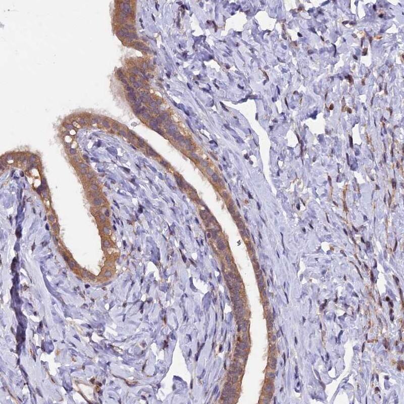 Staining of human fallopian tube shows cytoplasmic positivity in glandular cells.
