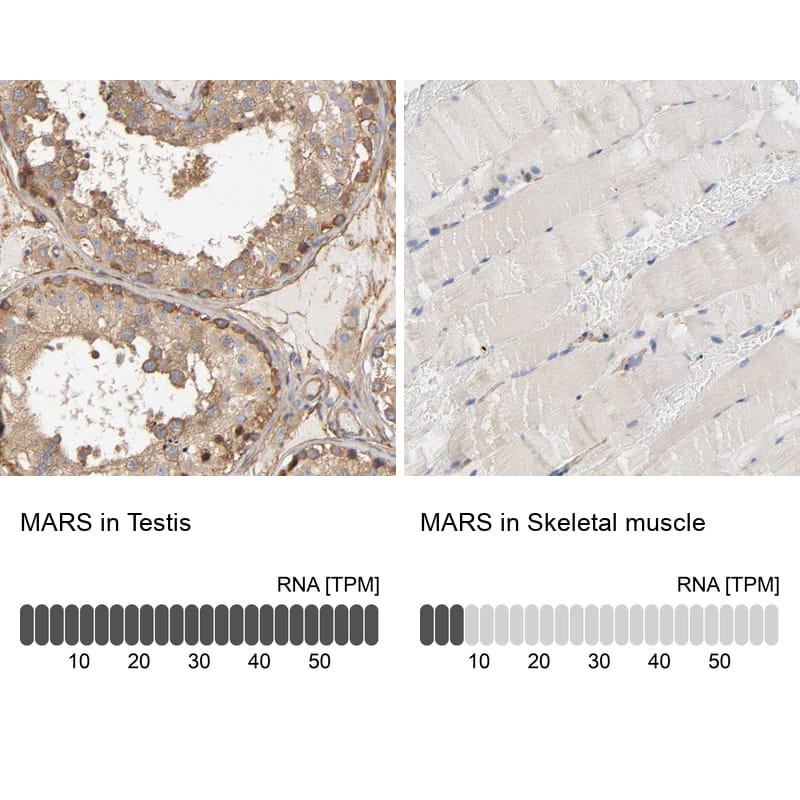 Analysis in human testis and skeletal muscle tissues. Corresponding RNA-seq data are presented for the same tissues.