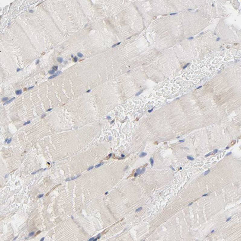 Staining of human skeletal muscle shows no positivity in myocytes as expected.