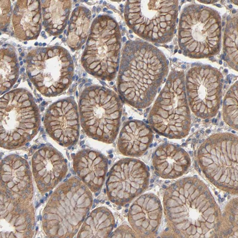 Staining of human stomach shows moderate membranous and cytoplasmic positivity in glandular cells.