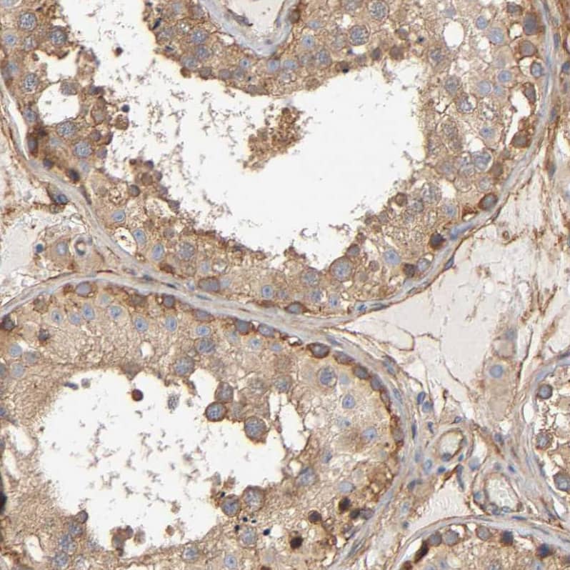 Staining of human testis shows strong membranous and cytoplasmic positivity in cells in seminiferous ducts.
