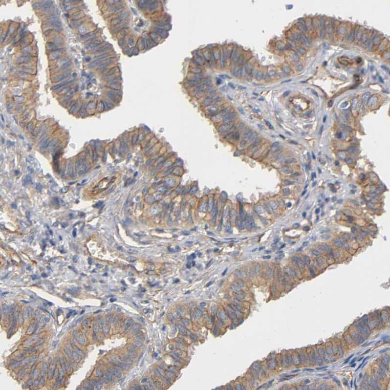 Staining of human fallopian tube shows weak to moderate membranous and cytoplasmic positivity in glandular cells.