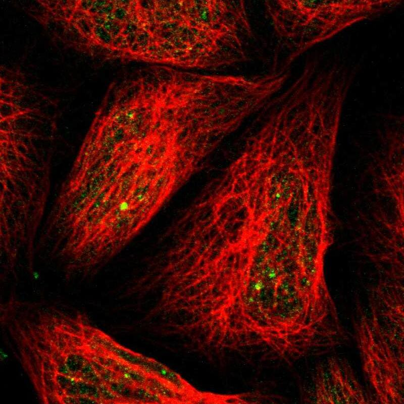 Staining of human cell line A-431 shows localization to nucleus.