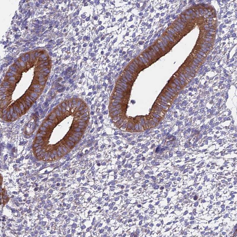 Immunohistochemistry-Paraffin Myosin VB Antibody - BSA Free