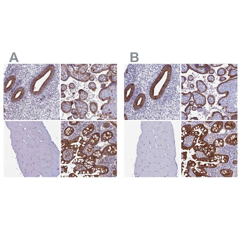 Immunohistochemistry-Paraffin Myosin VB Antibody - BSA Free