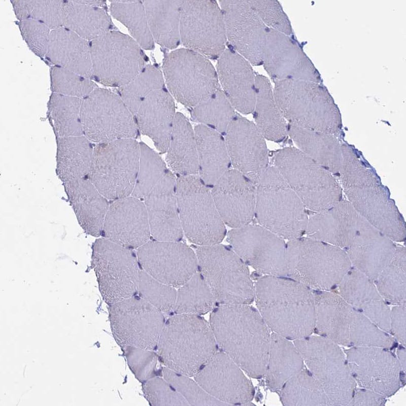 Staining of human skeletal muscle shows no positivity in myocytes as expected.
