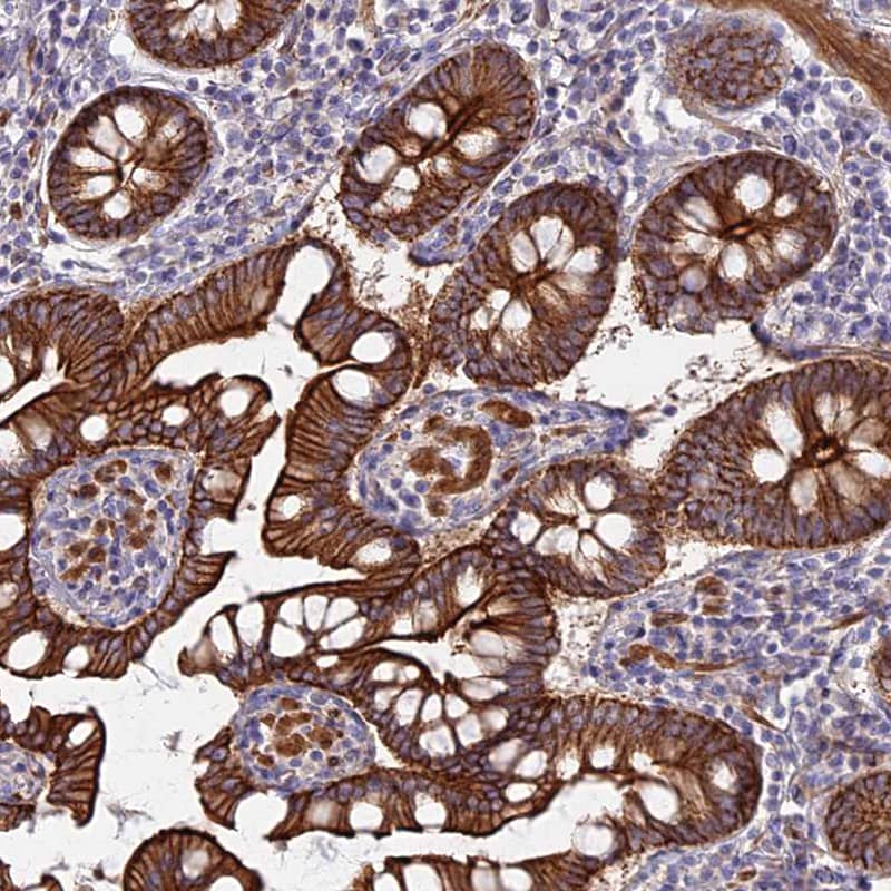 Staining of human small intestine shows membranous and cytoplasmic positivity in glandular cells.