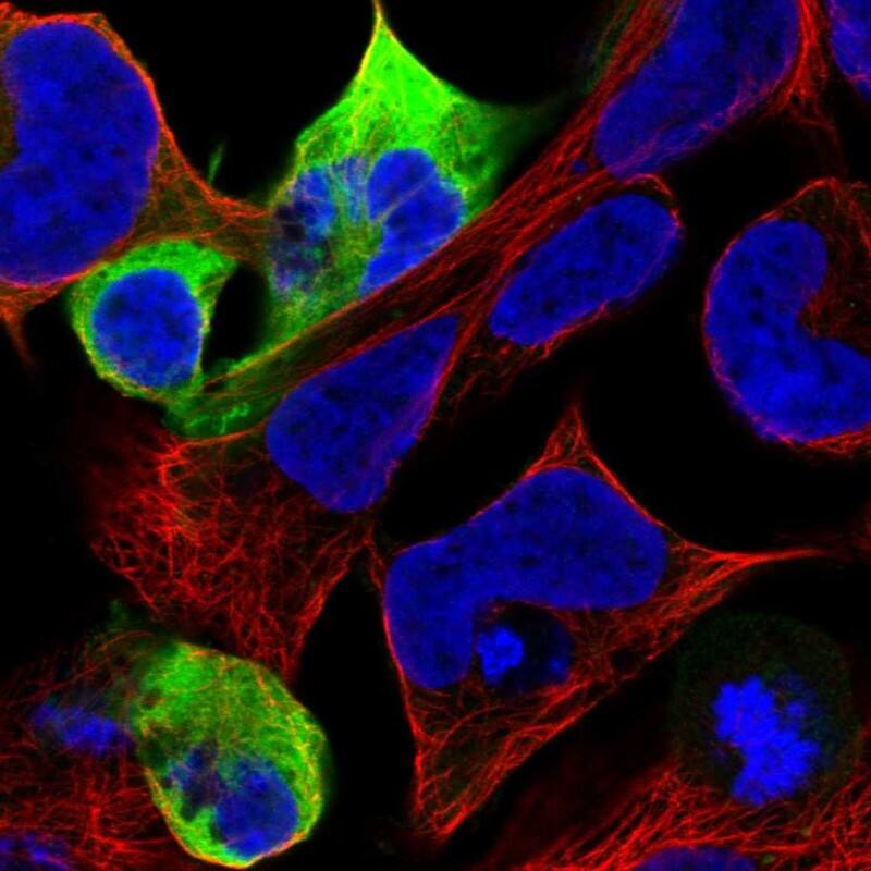 Staining of human cell line HEK 293 shows localization to intermediate filaments.
