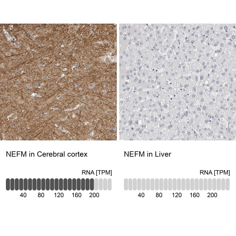 <b>Orthogonal Strategies Validation. </b>Analysis in human cerebral cortex and liver tissues. Corresponding RNA-seq data are presented for the same tissues.